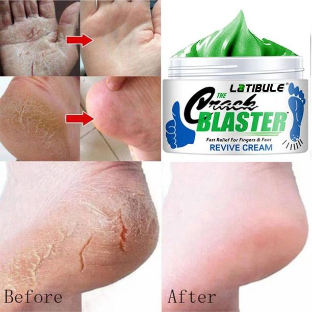 Latibule Foot Crack Cream For Dry Cracked Heels & Feet